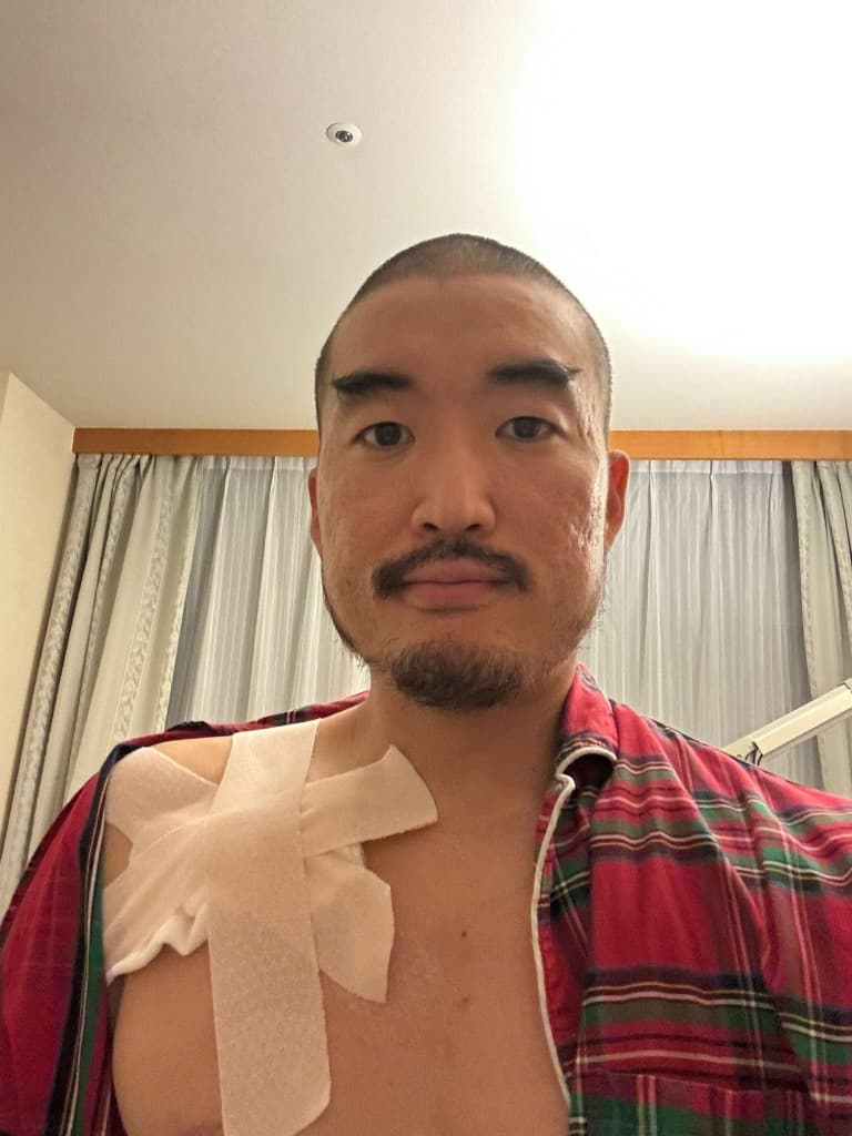 Selfie after CV port surgery with chest bandage in hospital room